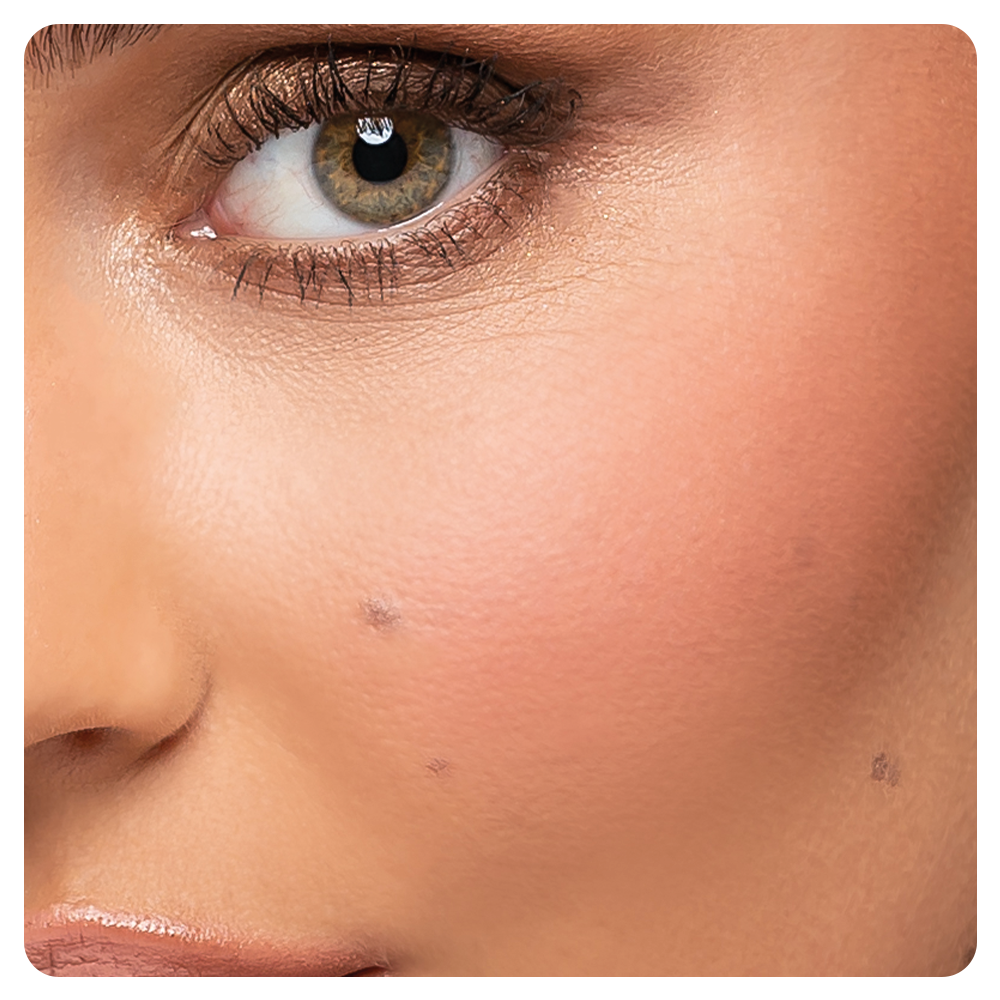 Cheek